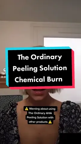 Quick warning for you beauties 👀 #skincare #ordinarypeelingsoultion #chemicalburn