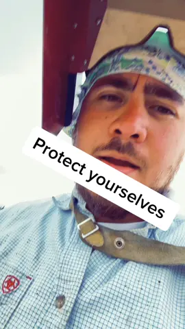 Burns aren’t cool 😂#welder #fyp #oilfeild #constructiontips #work#pipeline