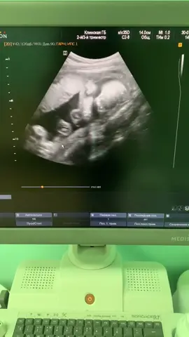 без лишних слов🥰 #мама #беременность