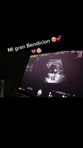 Te amo con toda mi vida 👶🏼🤰🏻💕 #embarazada #ecografia #pregnant #12semanas
