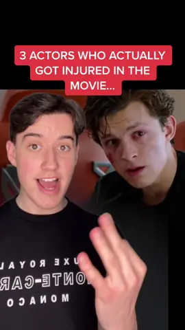 3 ACTORS WHO ACTUALLY GOT INJURED IN THE MOVIE! 😱 #fyp #facts