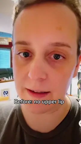 From no lip to lip. I can’t love this more!! #lipflip #QuickerPickerRapper