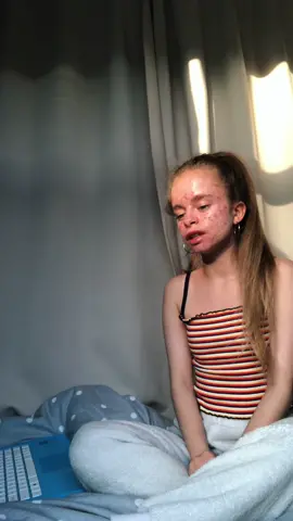 I was going through my videos and I forgot I filmed this, I done this a year ago and I know I look really rough 😂😂 #fyp #cover #radiohead #singing