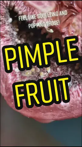 #pimple #pimplepopping #fruit #fruitchallenge #pop #pimplepopper #pimplepopperloverr