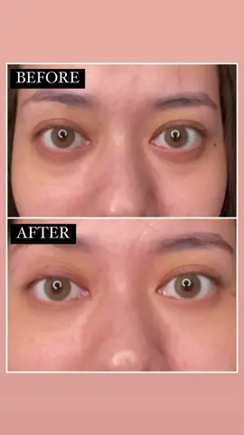 nemu di #fyp dan AMAZINGLY sih. WAJIB BGT COBA #npure 🥲❤️@npureofficial