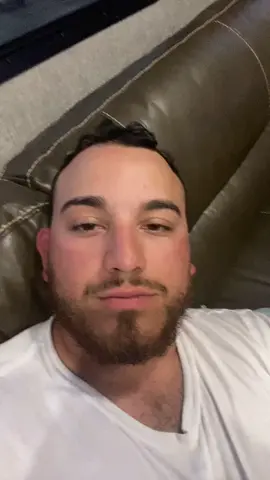 It works hahaha #fyp #fypシ #crosseyed