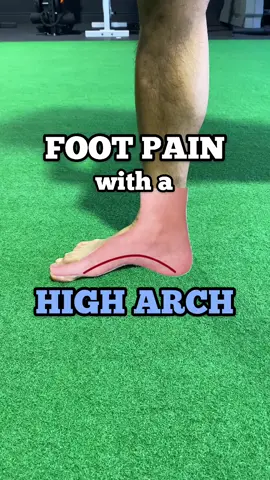 Foot pain with High arches #footpain #higharch #higharchfeet #physio #physiotherapy
