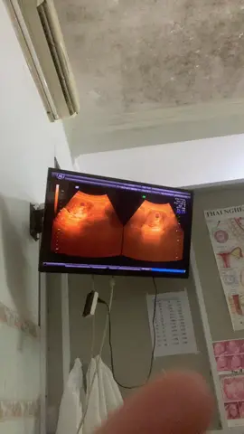 Cảm giác đi khám thai một mình nó ntn ạ 😔😔