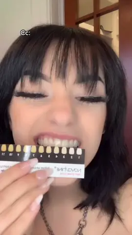 My teeth felt so clean for the rest of the day 🤭 @novashinesmile #novashinesmile ✨