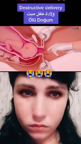 #дуэт с @dr.sayf 😭😭😭😭😭😭😭