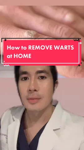 How to REMOVE WARTSat HOME ##healthtokph#fyp #foryou #wartremoval #wart #skincare #skincareroutine #skintok