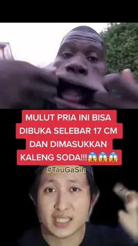 Mulut kalian bisa kayak gini gak?😱 #TauGaSih #samasamabelajar #fyp #foryourpage #foryoupage #foryou #fy #berbagifakta #kelastiktok #kelasonline