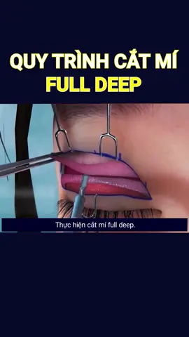 #drduc #nguyentrongduc #adona_tmv #catmi #catmideepa #catmiuytin #thuonghieu6namchuyenmat