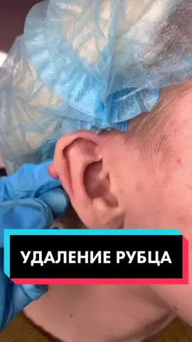 Подпишись, чтобы не пропустить #татувладивосток #пирсинг #владивосток