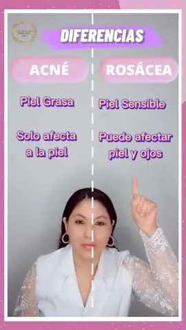 Sabes diferenciar entre Acné y Rosácea ❓❓#acne #rosácea  #pielsensible  #pielsana  #tratamientosfaciales #dermatología #parati #creador #limaperu