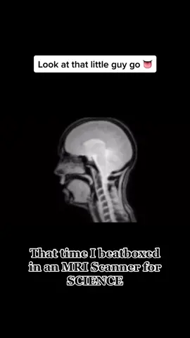 #mri #Science #beatbox #linguistics #brain #tongue #beatboxer #beatboxing #beatboxmyths #beatboxvids #beats #coolio