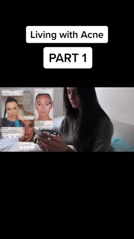 I don’t have perfect skin... Living with acne Part 1 #acneskin #acneconfidence #acnetreatment #accutane #acnecheck #acnefighter #acne #skinconfidence