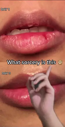 Get a #lip makeover w/ the #HYDRAGLOSS 👄 #fyp #issyandcompany #viral #beforeafter #lipmask #lipcare #drylips #foryourpage #lipoil #foryoupage #gloss