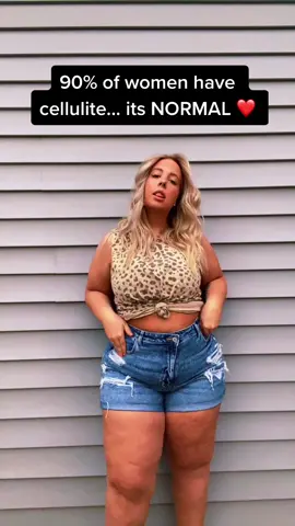 cellulite is normal babe, you look great #fyp #plussizeedition #bodypositivity #cellulite
