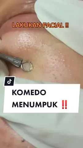 #fypシ #fyp #fypdongggggggg #komedo #komedohilang #komedobanyak #facialtreatment #facial #facialkomedo #salonprofessional #salonbanyuwangi
