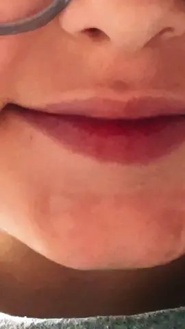 #ASMR putting in rubber bands￼ fans for my braces￼￼