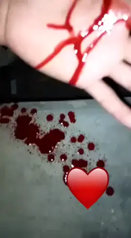#blood on hand #foryou #foryou #foryou