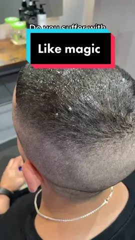 Many good products out there! #dandruff #barbershop #barber #haircut #mensgrooming #health #skincare #oddlydatisfying #funny #satire