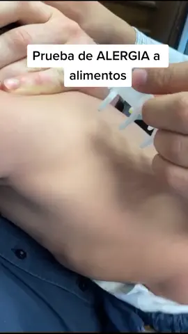 #allergien #pruebasdealergia #alergologomonterrey #doctoralergia #gripa #urticaria #alergiasmonterrey #alergologoenmty #alergias #doctor