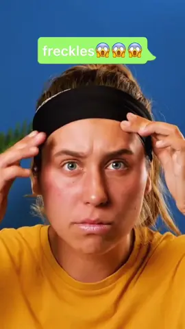 Try this way, keep the freckles away 🥳🥳🥳#foryou #foryourpage #beautiful #freckles