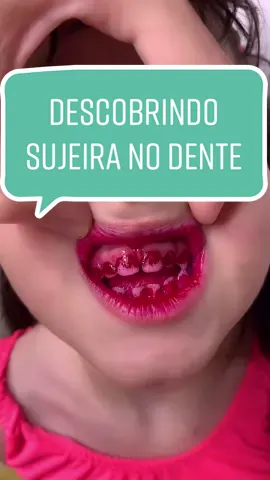 Baixe o app TIKTOK LITE, clica na moeda e coloca o código: K505913238 e ganhe DINHEIRO💰 #dentista #odonto #dentistanotiktok #odontonotiktok #fy #fyp