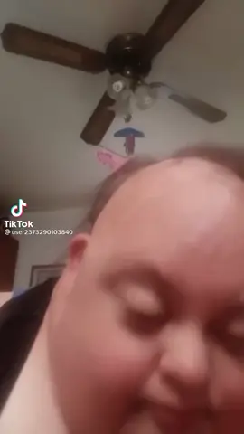 #fyp #foryou #foryoupage #viral #funny #downy #frowny #downsyndrome #funnyaf #hahaha