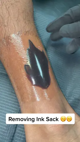 Who else has had this? Lmk what you Guys think 🤔 #inksack#inksacktattoo#inksackpop#insta#inkbykris#irvineinktattoo#orangecounty#fypシ#followme