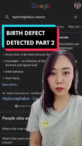DO NOT GOOGLE. REPEAT. NO TO DR. GOOGLE! #birthdefect #fyp #hydrocephalus #cleftlip #praningmoments  #trustGod #tipsforbaby #hereforyou @pjprnz