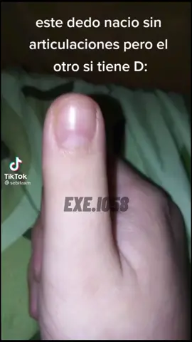@sebitaxm #viral #virall #PARATI #fypシ #😔 #sigueme_para_mas_videos_asi #parati