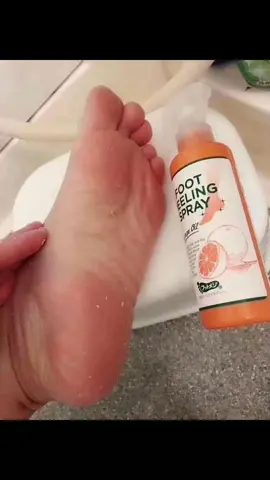 🇰🇷🇰🇷بخاخ مقشر الاقدام الكوري🇰🇷🇰🇷مقشر قدم كوري بخاخ 🦋بخاخ تقشير القدم الفوريازالة الكوع الداكن | الركبة |