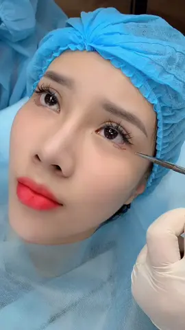 MỞ GÓC MẮT HẠ LỆ TRUNG HOA ✨✨ nhẹ nhàng tự nhiên _ Kỹ thuật cam kết KHÔNG ĐỎ _ KHÔNG NGỬA_ KO đau ko bầm tím😉😉❤️❤️#HangNhungEva #daotaohocvien