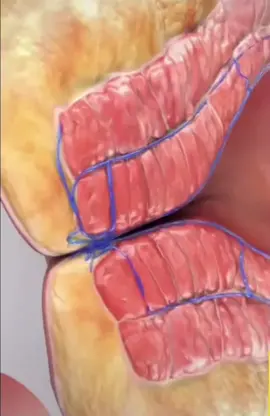 اختبر معلوماتك ..ماهو اسم العملية ؟.        #د_خلدون_الحوراني #medicine #fyp #tipsandtricks #doctor
