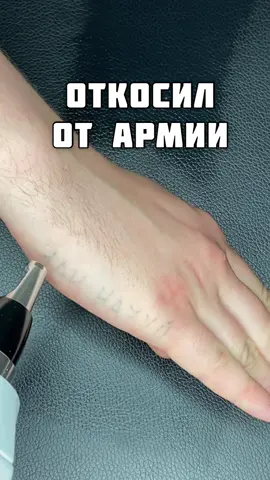 Магия вне Хогвартса😅#тату #tattoo #tattooremoval