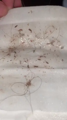 Don’t let this flop I went allll out for ur satisfaction #licetok #liceasmr #satisfying #fyp #headlice