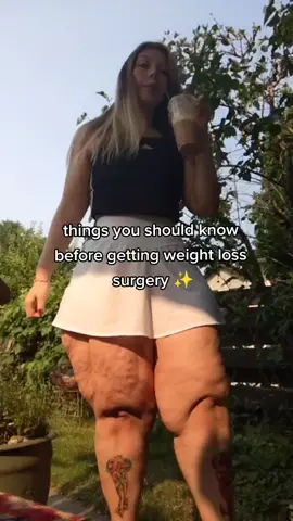 surgery isn't always as easy as you think but definitely worth it 💕😊 #weightloss #vsg #fyp