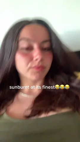 lmfao someone remind me to put sub team on next time 🌝 #fyp #sunburnt #foryou #uk #follow #hot