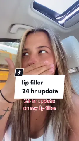 thank you again @tuscaloosamedspa im obsessed 😍 #lipfiller