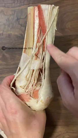 Achilles (Calcaneal) Tendon. #anatomy #anatomylesson #anatomylab #plastination #achilles