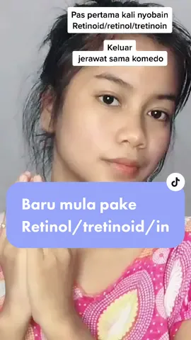 Yah begitu lah kira hasilnya baguss #fyp #retinol #retinolskincare #retinoltips #retinolpurging #tretinoin