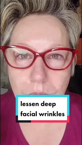 Let's flatten some wrinkles!  #lipwrinkles  #marionettelines  #nasalfolds #frownlines  #crowsfeet