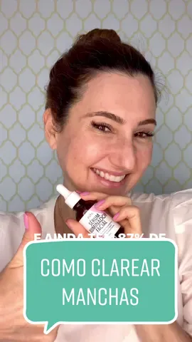 Você faz parte desse grupo? #pele #melasma #skincare #manchasnapele #sardas #coroasnotiktok #skin #fy