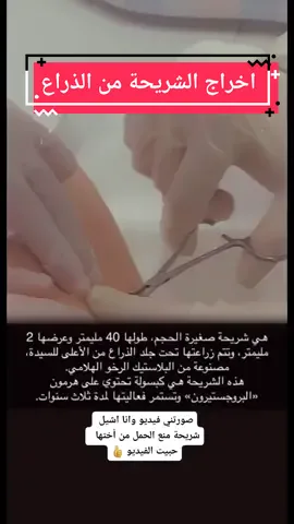 صورني وانا مدري 😁✌ #صحة_المرأة #صوت_الطبيب #اسأل_طبيبك #jeddah #جدة #doctors #السعودية #صورني_شكراً #صورني_واني_مادري