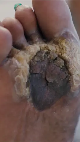 Is this foot really ~cursed~ 😳 #MyFeetAreKillingMe #TLC