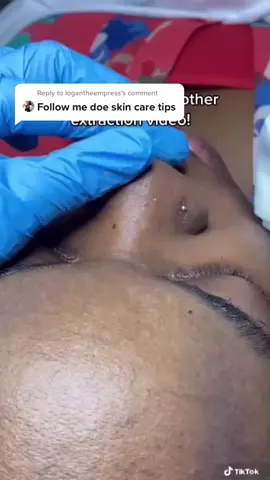 Reply to @logantheempress I can show you how to never let that happen repost@Skinistry Aesthetics & Laser  #skincare#skincareroutine #logantheempress