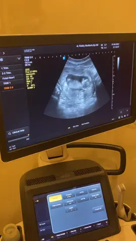 Alhamdulillah menginjak Trimester 2 kehamilan istriku @candi_keylamet , Janin bayi sehat & normal #storyofmylife #rizalcandi #fahrizal #candiwengi #trimester2 #kontrolkandungan #debay #usg #usgkandungan